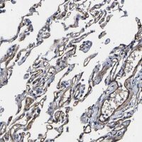 Anti-KLHL42 antibody produced in rabbit 