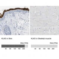 Anti-KLK5 antibody produced in rabbit 