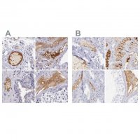 Anti-KNG1 antibody produced in rabbit 