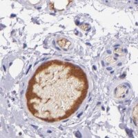 Anti-KNG1 antibody produced in rabbit 