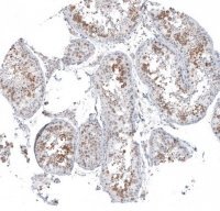 Anti-KNSTRN antibody produced in rabbit