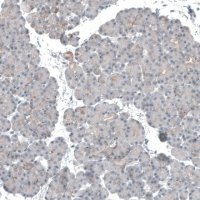 Anti-KNSTRN antibody produced in rabbit