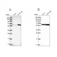 Anti-KPNA4 antibody produced in rabbit HPA045500-100UL