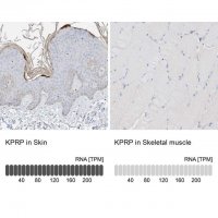 Anti-KPRP antibody produced in rabbit 