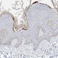Anti-KPRP antibody produced in rabbit 