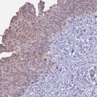 Anti-KRR1 antibody produced in rabbit