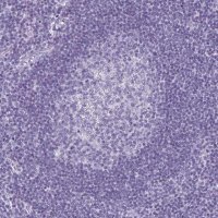 Anti-KRT10 antibody produced in rabbit