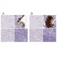 Anti-KRT12 antibody produced in rabbit 