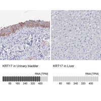Anti-KRT17 antibody produced in rabbit 
