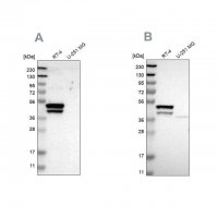 Anti-KRT23 antibody produced in rabbit 