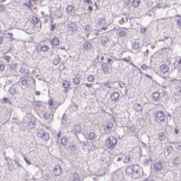 Anti-KRT25 antibody produced in rabbit 