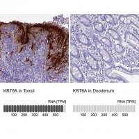 Anti-KRT6A antibody produced in rabbit