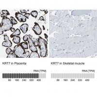 Anti-KRT7 antibody produced in rabbit