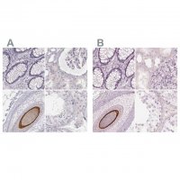 Anti-KRT82 antibody produced in rabbit 