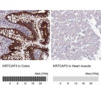 Anti-KRTCAP3 antibody produced in rabbit HPA047136-100UL