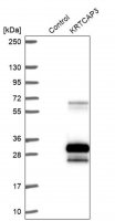Anti-KRTCAP3 antibody produced in rabbit HPA047136-100UL