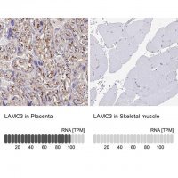 Anti-LAMC3 antibody produced in rabbit 
