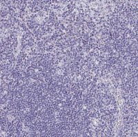Anti-LAMC3 antibody produced in rabbit 