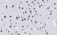 Anti-Lamin A/C Antibody, clone 2B10 ZooMAb� Rabbit Monoclonal 