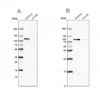 Anti-LARP4B antibody produced in rabbit