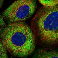 Anti-LARP4B antibody produced in rabbit