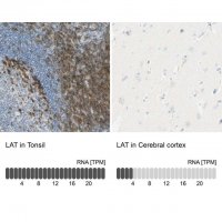 Anti-LAT antibody produced in rabbit 