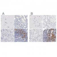 Anti-LAX1 antibody produced in rabbit HPA002461-100UL