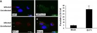 Anti-LC3B antibody produced in rabbit 