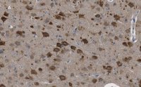 Anti-LC3B Antibody, clone 12K5, ZooMAb� Rabbit Monoclonal 
