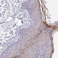Anti-LCE6A antibody produced in rabbit 