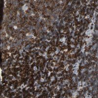 Anti-LCK antibody produced in rabbit 