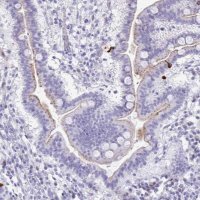 Anti-LCN15 antibody produced in rabbit 