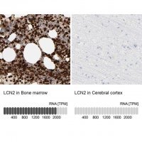 Anti-LCN2 antibody produced in rabbit 