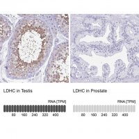 Anti-LDHC antibody produced in rabbit 