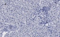 Anti-LDL Receptor Antibody, clone 2N19, ZooMAb� Rabbit Monoclonal 