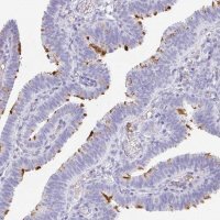 Anti-LDLRAD1 antibody produced in rabbit