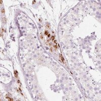 Anti-LECT2 antibody produced in rabbit 