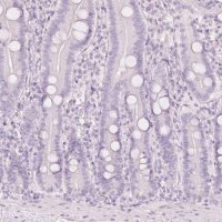 Anti-LECT2 antibody produced in rabbit 