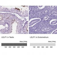 Anti-LELP1 antibody produced in rabbit