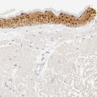 Anti-LGALS7 antibody produced in rabbit HPA001549-100UL