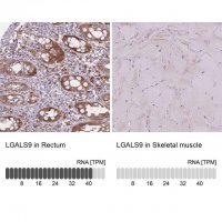 Anti-LGALS9 antibody produced in rabbit 