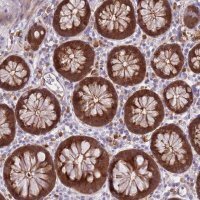Anti-LGALS9 antibody produced in rabbit 