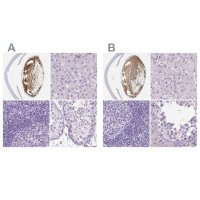 Anti-LGSN antibody produced in rabbit 