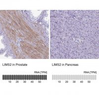 Anti-LIMS2 antibody produced in rabbit