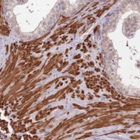 Anti-LIN37 antibody produced in rabbit 