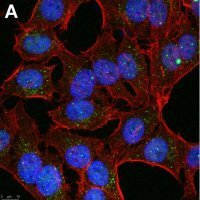 Anti-Linear Ubiquitin Antibody, clone 1E3 ZooMAb� Rabbit Monoclonal 