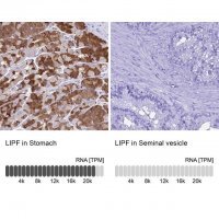 Anti-LIPF antibody produced in rabbit 