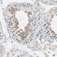 Anti-LMAN2 antibody produced in rabbit HPA003927-100UL