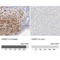 Anti-LMOD1 antibody produced in rabbit 