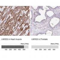 Anti-LMOD2 antibody produced in rabbit 